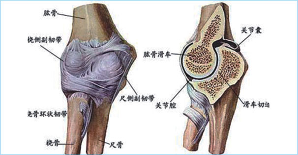 腰椎间盘突出