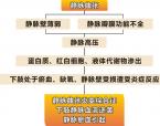 三泵加压循环治疗体系