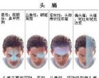 长期吃止痛药对治疗有效吗？