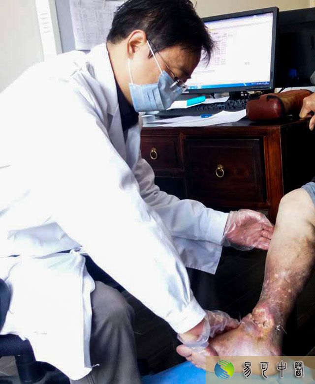 张磊看诊老烂腿