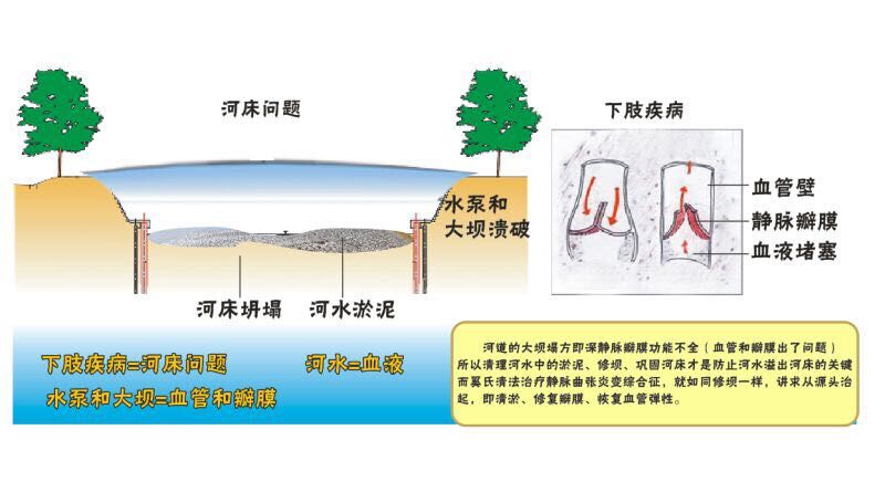 下肢溃破5年不愈，“奚氏清法”上阵2年未溃破